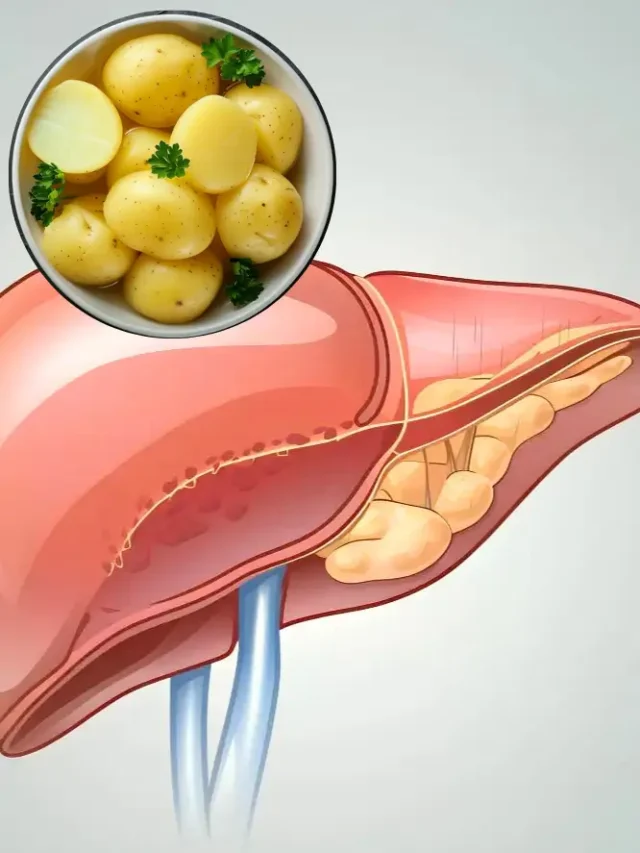 fatty liver me aalu khana Chahiye